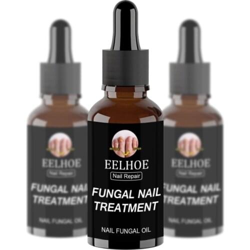 Fast Fungal Nail Treatments Serum Onychomycosis Paronychia Anti-Fungal Nail Sensitive Herb Toe Fungus Foot Repair Essences Care