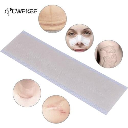 7Styles Silicone Gel Sheet Scar Away Patch Removal Wound Marks Cesarean Keloid Skin Scars Therapy Treatment