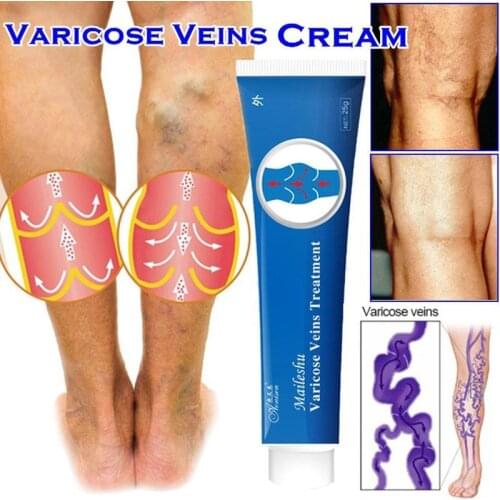 2020 new Varicose Veins Treatment Cream Varicosity Angiitis Remedy Ointment