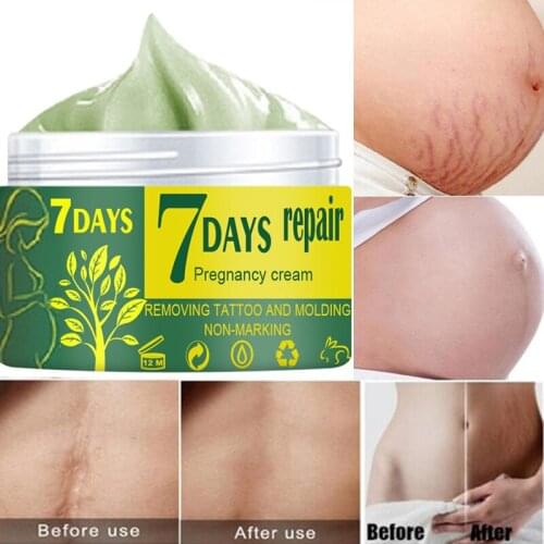 Pregnancy Repair Cream Stretch Marks Acne Scar Removal Gravidarum Treatment Skin Body Repair Whiting Cream 10/30/50g