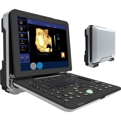 Portable 4D Color Doppler Ultrasound & 15inch medical LED display medical ultrasound 4d obstetric ultrasound
