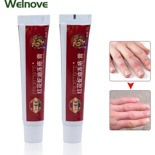 30g Heel Chapped Cracked Repair Cream Hand Foot Crack Cream Repair Frostbite Anti Dry Crack Medical Ointment Skin Moisturizing