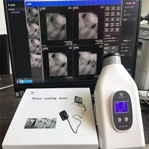 Dental X Ray Sensor Digital Intraoral System DynImage Imaging High Resolution Win 7.8.10 Compatible X-Ray Sensor
