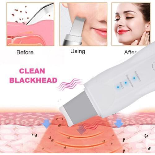 Not Ultrasonic Skin Scrubber Rechargeable Deep Face Cleaning Skin Care Vibration Massage Remove Dirt Blackead Facial Peeling