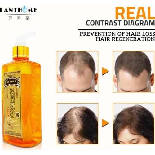 300ml Herbal Ginger Shampoo Fast Hair Growth Anti Hair Loss Products Hair Care Straighten Smooth Shinning Hair Scalp Treatments