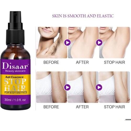 Permanent Painless Hair Removal Spray Inhibit Hair Smooth Body Beauty Sprays Spray Non-Irritating Skincare Essence Growth D8P9