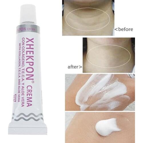 40g Neck Cream Xhekpon Crema Face And Neck Cream 40ml Neckline Cream Wrinkle Smooth Anti Aging Whitening Cream