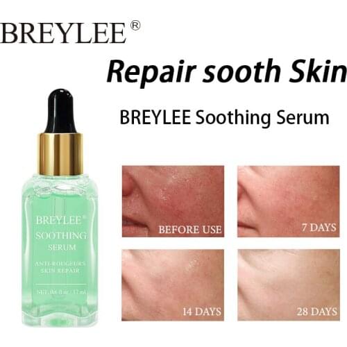 BREYLEE Soothing Repairing Face Serum Fade Redness Anti Acne Moisturizer Nourishing Remove Scar Treatment Sensitive Skin Essence