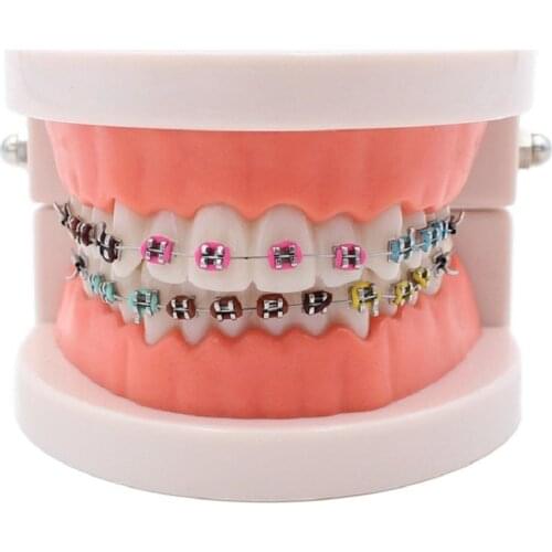 Dental Orthodontic Treatment Model With Ortho Metal Ceramic Bracket Arch Wire Buccal Tube Ligature Ties Dentist Tools Lab