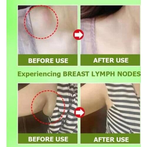H7JC Patches Organic Lymphatic Drainage Detox Patch Anti-Swelling Patch Effective Painless Treatment Breast Lymph Nodes Patch
