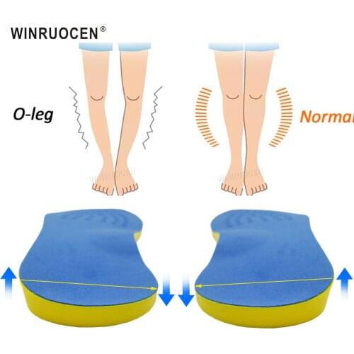 Plus size O/X-Leg Orthopedic Insoles Arch support insole corrigibil Bow Legs Valgus Varus Massaging Shoe pads Beauty Feet Ca