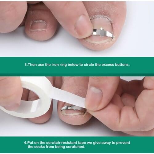 Ingrown Toe Nail Correction Tool Toenail Straightening Correctors Patch Tool Straightening Clip Brace Pedicure Tool