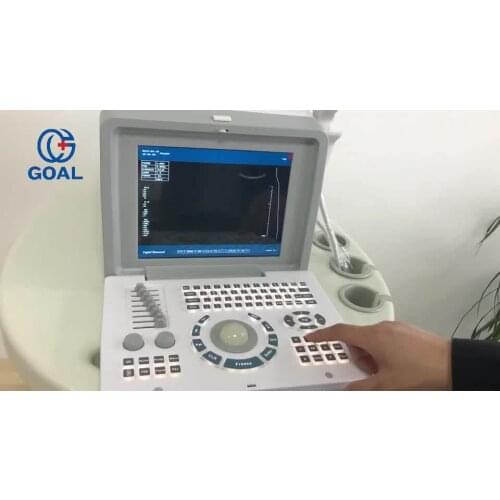 Cheap ultrasound machine/Notebook color doppler ultrasound,portable ultrasound