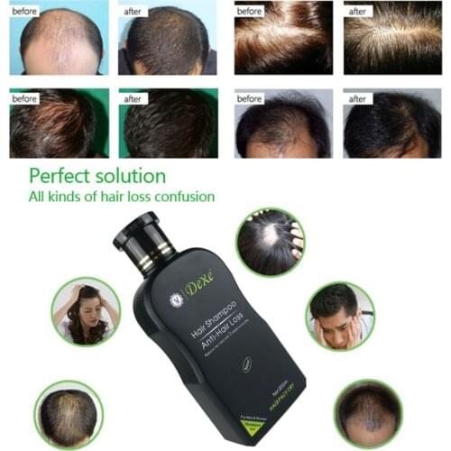 Dexe Hair Growth Shampoos