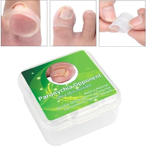 2Pcs Toe Nail Ingrown Correction Foot Care Paronychia Silicone Corrector Sleeves Ingrown Toenail Corrector Sleeves Pedicure Tool