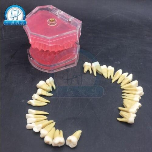 Oral education training exelcymosis practicing model extract tooth Removable tooth model