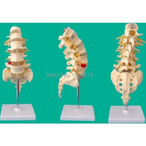 Life-Size Lumbar Vertebrae with Sacrum and Coccyx Model, Lumbar Vertebrae and caudal vertebra Model