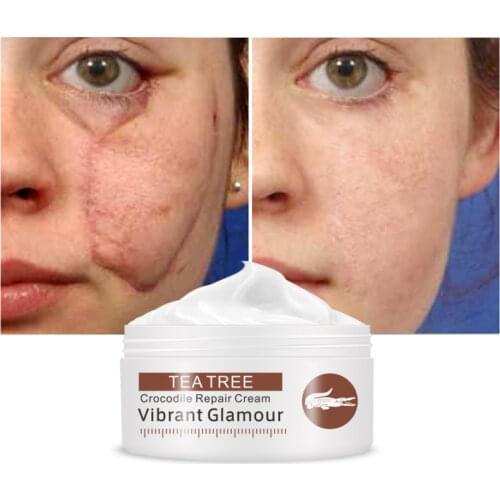 VIBRANT GLAMOUR 30g Crocodile Repair Scar Acne Cream Facial Treatment Repair Cream Stretch Marks Treatment Whitening Day Creams