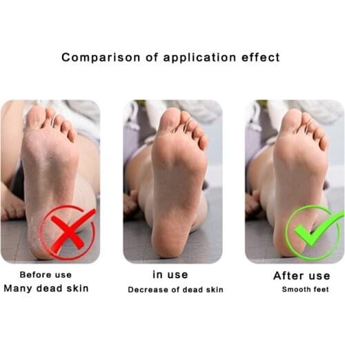 BX0F Multi Purpose 4 in 1 Feet Pedicure Tools with Foot Scrubber Pumice Stone Rasp File Callus Remover for Home Foot Care