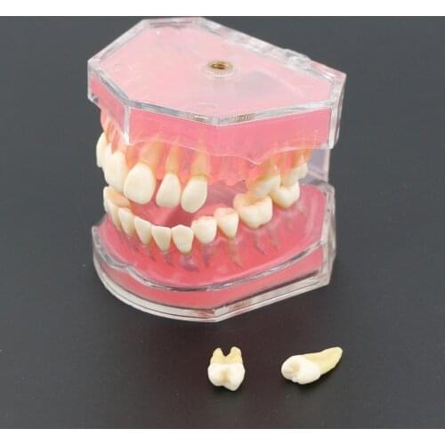 Dental Standard Model with Removable Teeth #4004 01 Dental Study Teach Teeth Model