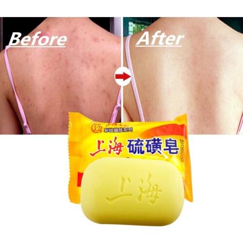 1pcs Shanghai Sulfur Soap Oil-control Acne Treatment Blackhead Remover Soap Whitening Cleanser Chinese Traditional Skin Care 85g