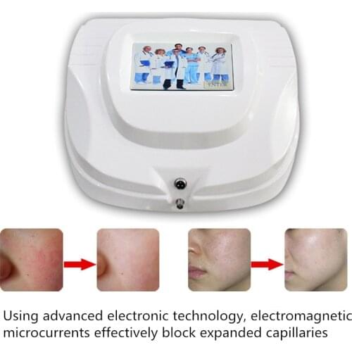 30MHZ High Frequency RBS Vascular Blemishes Telangiectasia Blood Removal machine/Micro needle spider vein vascular removal skin