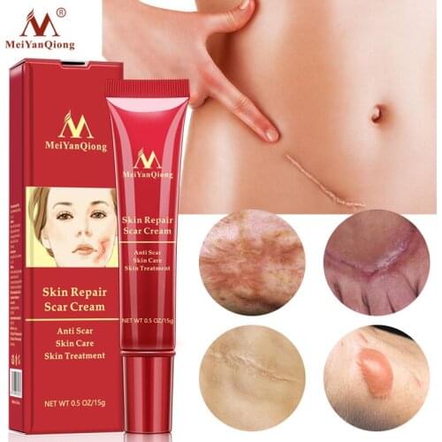 15g Scar Removal Cream Acne Scars Gel Stretch Marks Surgical Scar Burn For Body Pigmentation Corrector Acne Spots Repair Care