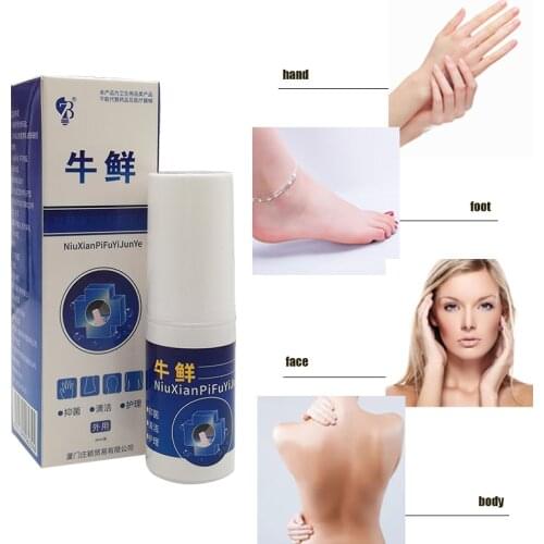 Psoriasi Eczma Cream Works Perfect For All Kinds Of Skin Problems