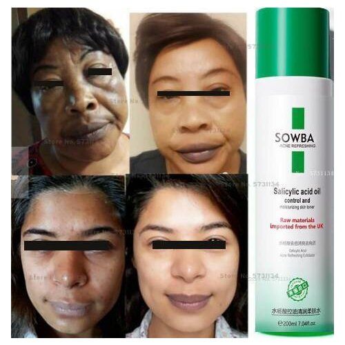 Salicylic Acid Exfoliating Toner , Dark Spots Remover , Skin Lightening Toner