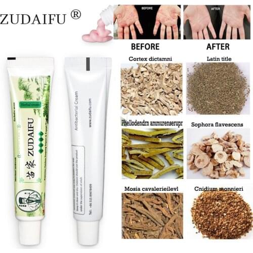 100% Original zudaifu Skin Psoriasis Cream Dermatitis Eczematoid Eczema Ointment Treatment Psoriasis Cream Skin Care Cream