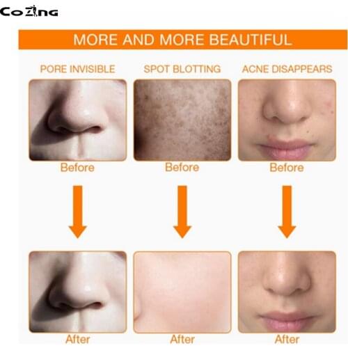 Beauty Product Pdt Led Machine Medical Device With Red Blue Light Home Use