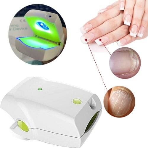 Cure-Ex Laser Nail Fungus Treatment Device Nail Fungus Killing Cold Laser Therapy Device 905nm diode laser para onicomicosis