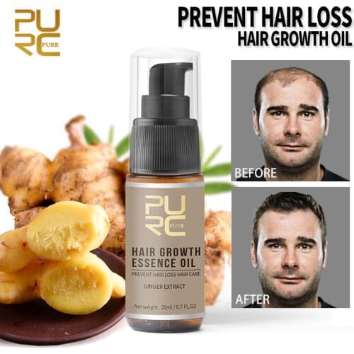 PURC 2019 Hot sale Fast Hair Growth Essence Oil Hair Loss Treatment Help for hair Growth Hair Care 20ml drop shipping