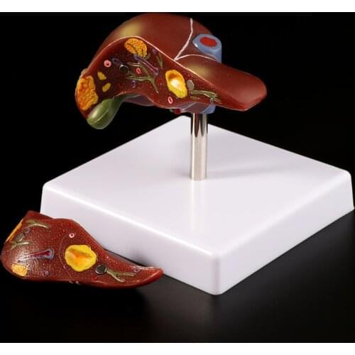 Human Liver Pathological Anatomical Model Anatomy School Teaching Display Tool Lab Equipment