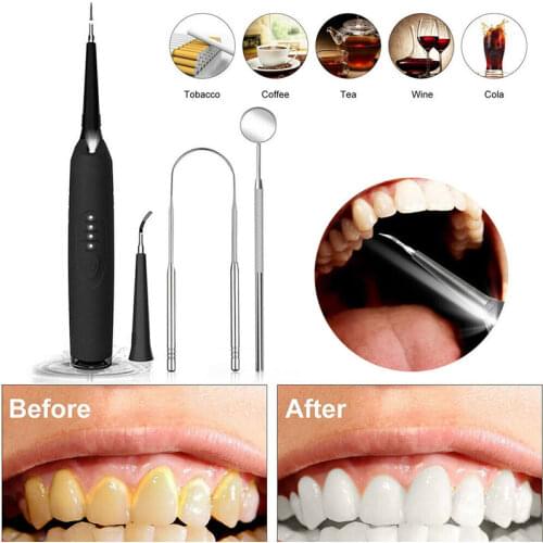 Electric Ultrasonic Sonic Scaler Tooth Calculus Plaque Remover Cleaner Tooth Stains Tartar Whiten Teeth Tool TSLM1