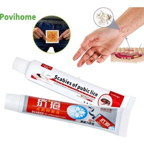 2Types Head Pubic Lice Removal Antipruritic Ointment Treat Psoriasis Eczema Dermatitis Cream Anti Itching Herbal Medical Plaster