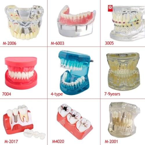Dental Teeth Model Training Dentistry Demonstration Standard Teeth Models Clear Model with Teaching and Science Dentist Material