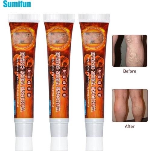 Sumifun 3pcs Treatment For Varicose Veins Chinese Herbal medicine For Varicosity Angiitis Removal Phlebitis legs Veins Ointment