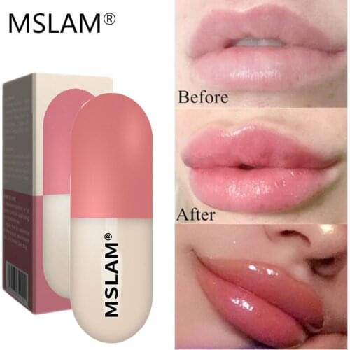 MSLAM Lip Balms