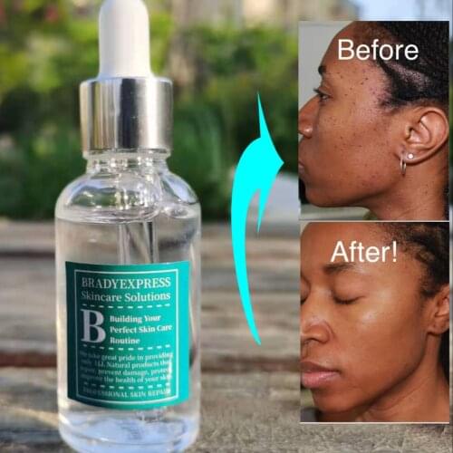 BRADYEXPRESS Hyaluronic Face Serum