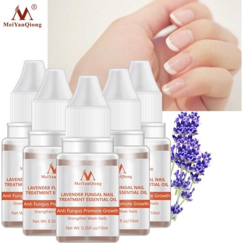 Nail Repair Essence Serum Fungal Nail Treatment Remove Onychomycosis Toe Nail Nourishing Brightening Hand And Foot Care Essence