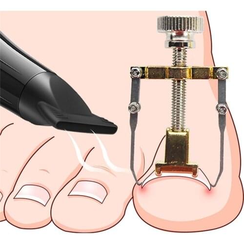 Ingrown Toenail Corrector Pedicure Toenail Fixer Foot Nail Care Orthotic Stainless Steel Treatment Onyxis Bunion Correction Tool