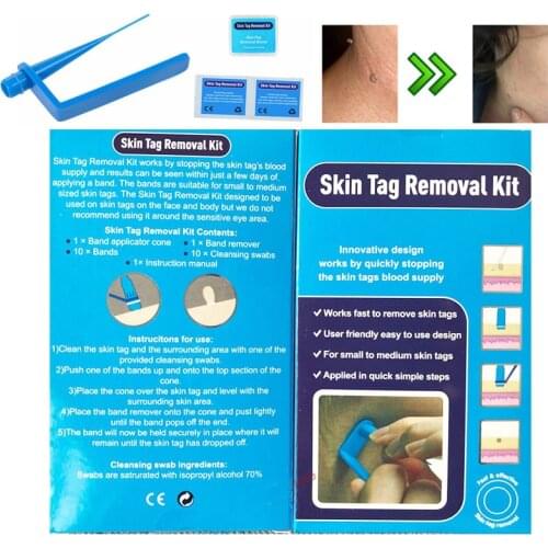 Non Toxic Removal Mole Wart Tool For Small To Medium Skin Care With Cleansing Swabs Micro Band Home Use Adult Tag Removal Kit