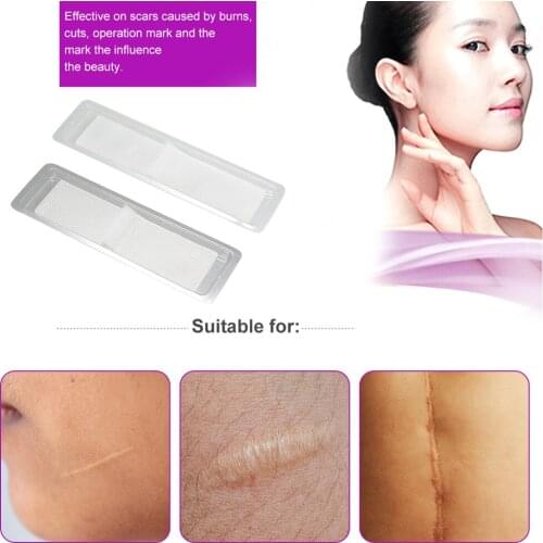 Scar Sheet from Surgery,Injury, Burns, Acne, C-section and more Scar Removal Treatment Sheet Soften and Flattens Scars Resulting