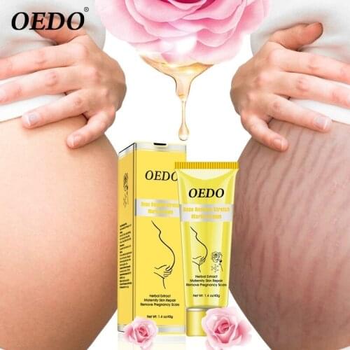 Rose Remove Stretch Mark Cream Nourish Moisturizing Anti-wrinkle Pregnant Women Skin Repair Remove Obesity Tattoo Body Care