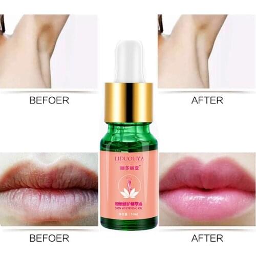 Vagina Whitening Cream Fade Melanin Melasma Oil Ageless Skinfood Pink Tender Skin Care Cherry Pinkish Essence Nipple Underarm