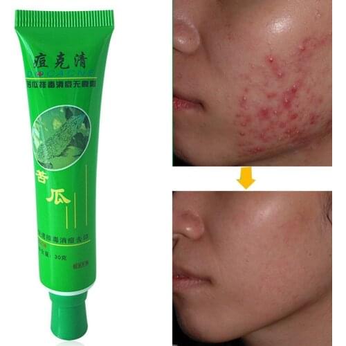 30g High Quality Face Cream Beauty Product Face Skin Repairing Acne Cream Oil Control Acne Remover Facial Skin Care Tool