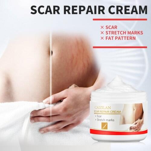 Precious Skin Care Body Cream Stretch Marks Repair Cream Removal Scar Marks Pregnancy Cream Fat Scar Striae Treatment TSLM2