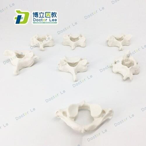 7pcs Anatomical Model of Human Cervical Spine Cervical Spondylopathy