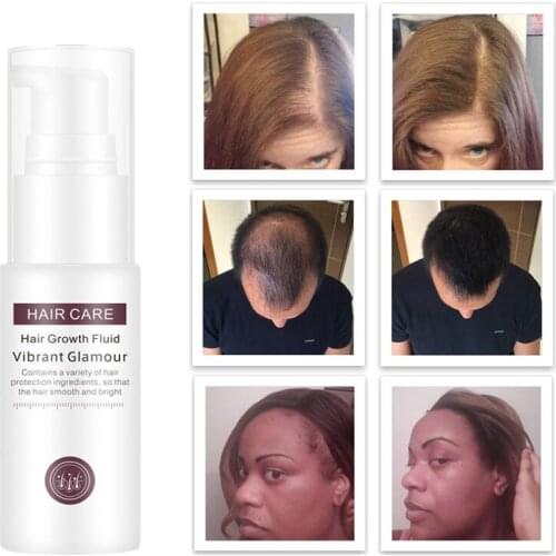 30ml Hair Growth Serum Essence Spray for Women and Men Anti Prevent Hair Loss alopecia Liquid Damaged Hair Growth Liquid
